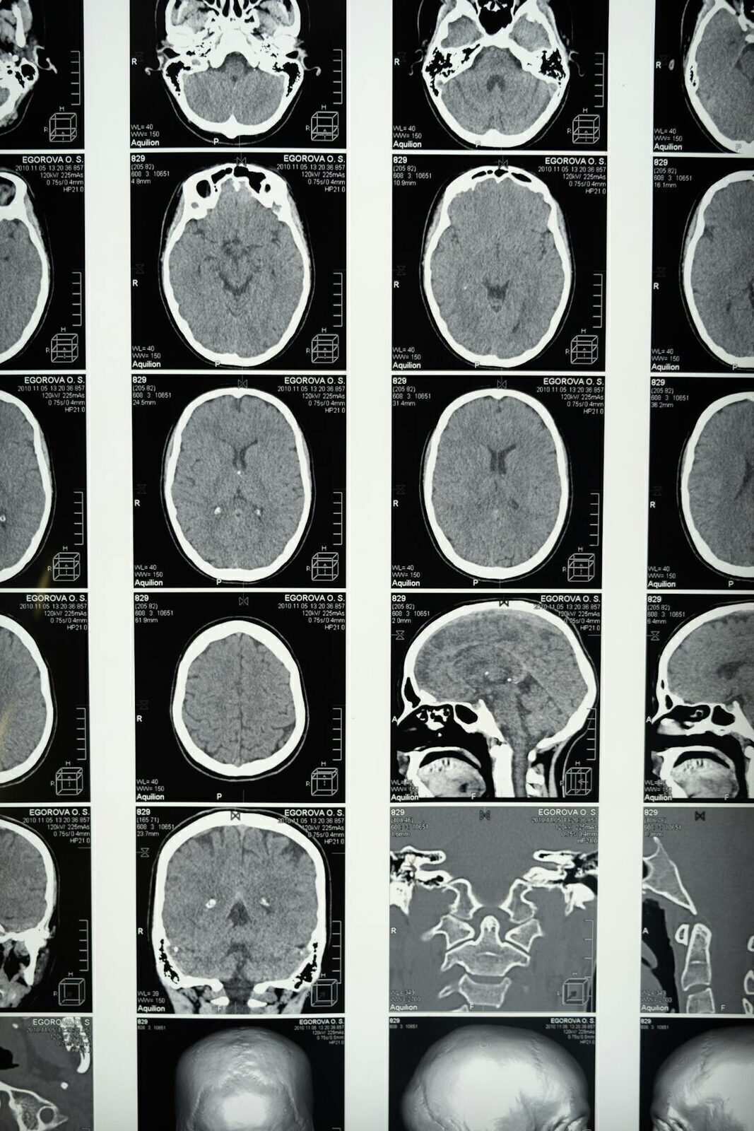 Brain Health & Cognitive Optimization